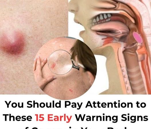 You Should Pay Attention to These 15 Early Warning Signs of Cancer in Your Body